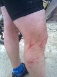 heridas de guerr	.jpg