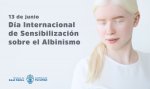 portada-dia-albinismo (1).jpg