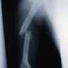 PorElChan